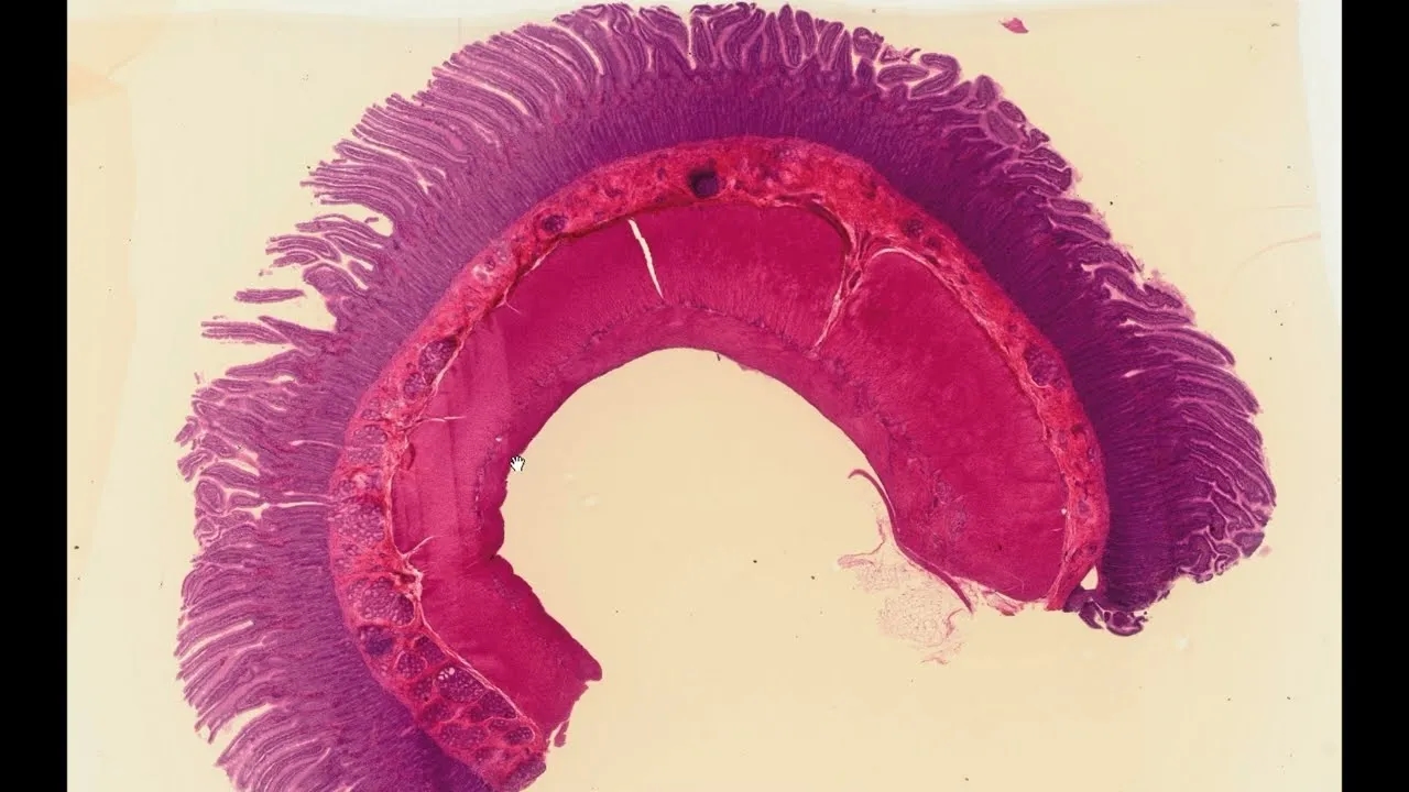 Gdzie leży dwunastnica? Odkryj jej położenie i znaczenie w ciele